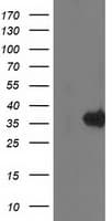 MGLL / Monoacylglycerol Lipase Antibody (clone OTI2B11)