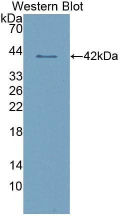 CD209 / DC-SIGN Antibody (aa70-404, Cy3)
