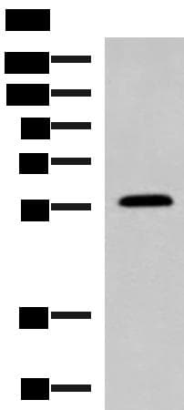 PEPD / PROLIDASE Antibody