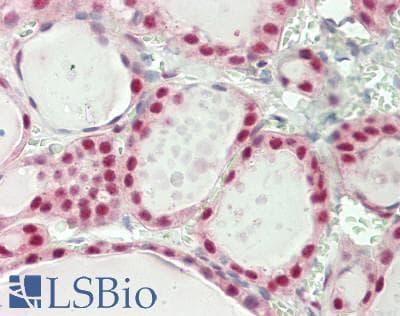 IHC-plus™ EIF4A3 Antibody (aa125-175)