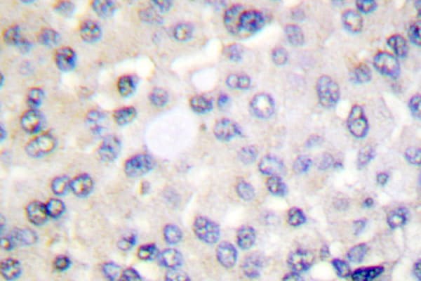 IRS1 Antibody (Arg301)