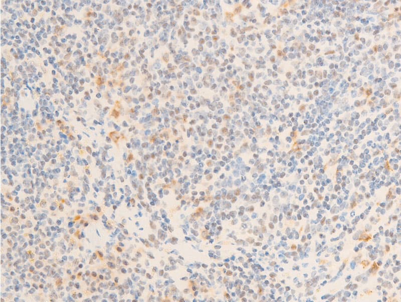 Polyclonal Rabbit anti-Human MYC / c-Myc Antibody (phospho-Ser62, IHC, IF, WB)
