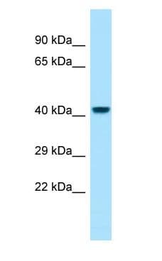 PGLYRP3 Antibody (aa61-110)