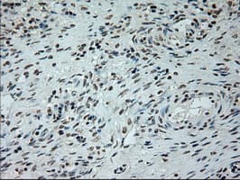 Monoclonal Mouse anti-Human L1CAM Antibody (clone OTI10C12, IHC, WB)