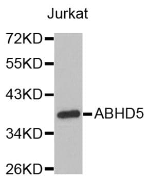 Polyclonal Rabbit anti-Human ABHD5 Antibody (WB)