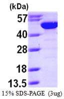 Human BLMH Protein (Recombinant His)