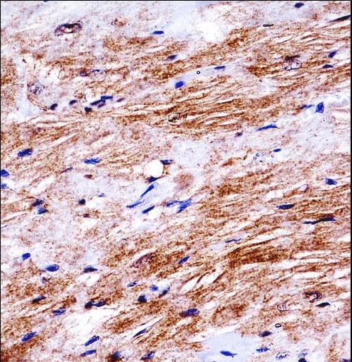 DDR2 Antibody (aa816-843)