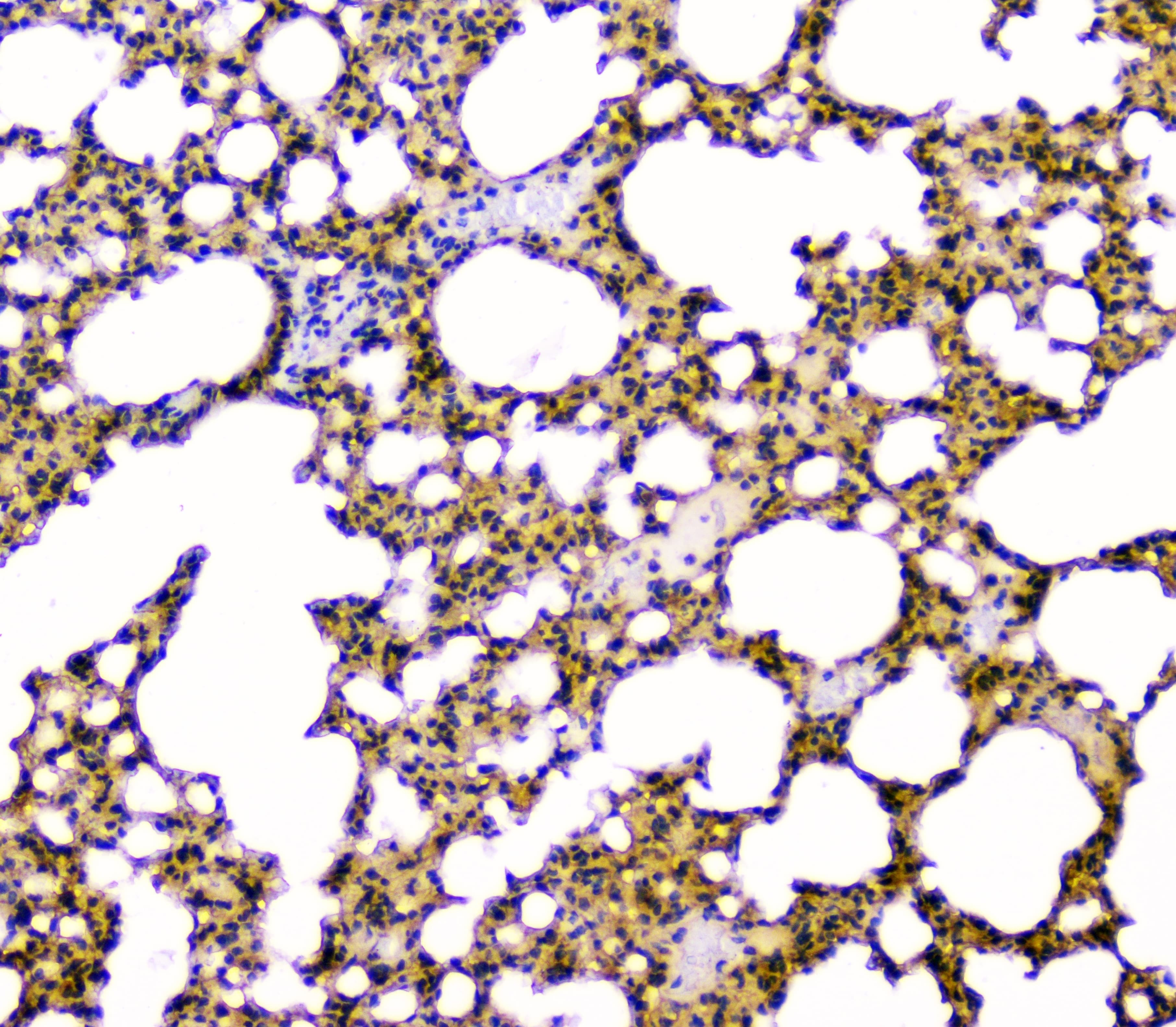 Polyclonal Rabbit anti-Human GOLPH3 Antibody (IHC, WB)