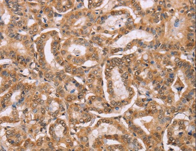 Osteocalcin Antibody