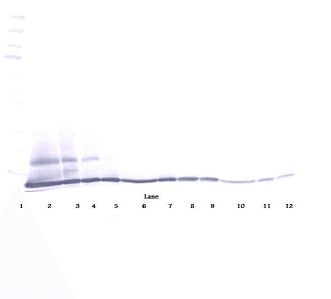 Polyclonal Rabbit anti-Human CCL27 Antibody (Biotin, WB)