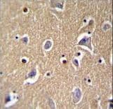 FBXO21 Antibody (aa474-501)