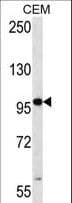Polyclonal Rabbit anti-Human RNF43 Antibody (aa543-572, IHC, WB)