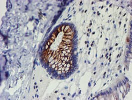 MEF2C Antibody (clone OTI2F2)