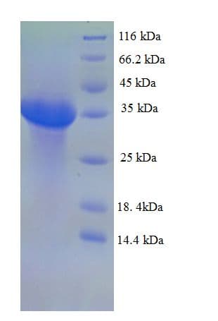Bovine EPO / Erythropoietin Protein (Recombinant His-SUMO)