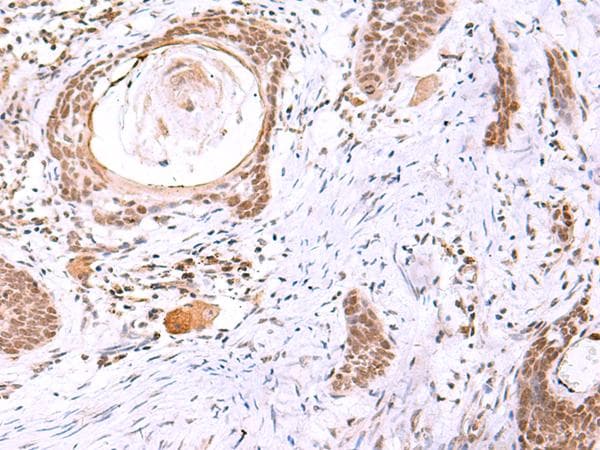 Polyclonal Rabbit anti-Human ITPKC Antibody (IHC)