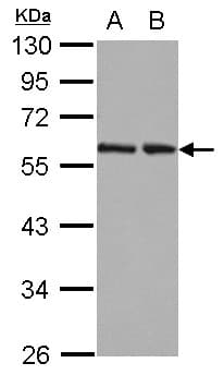 IHC-plus™ Polyclonal Rabbit anti-Human RAD23B / HR23B Antibody (IHC, IF, WB)