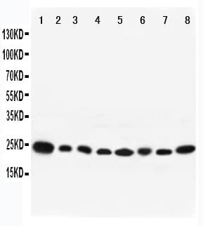 RAB8A / RAB8 Antibody (aa170-183)