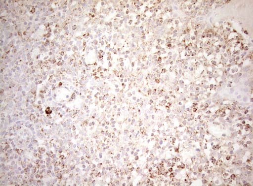 Monoclonal Mouse anti-Human DECR1 Antibody (clone OTI4G4, IHC, WB)