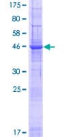 Human ARL6IP6 Protein (Recombinant GST)
