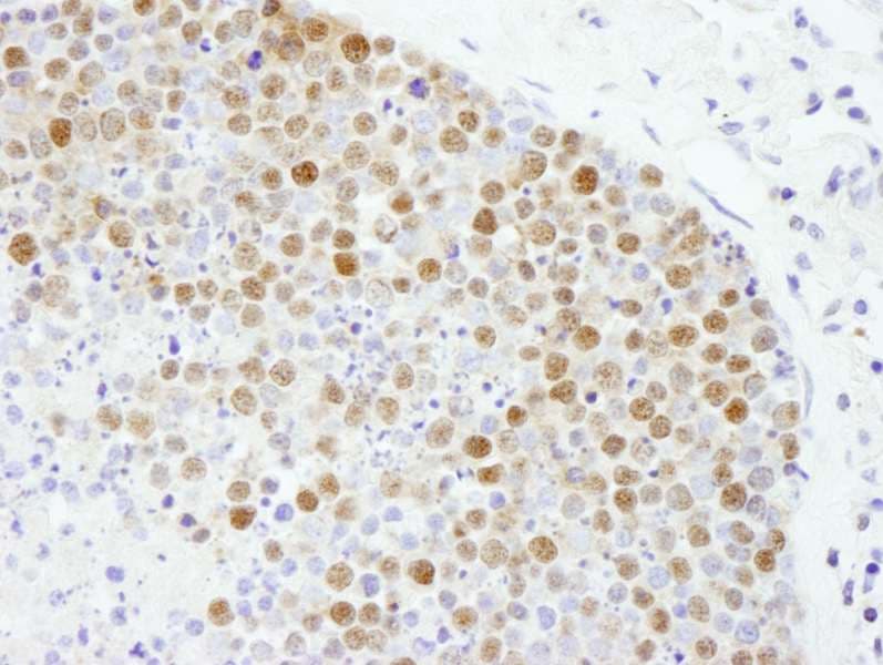 Polyclonal Rabbit anti-Human FEN1 Antibody (aa250-300, IHC)