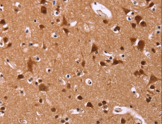Polyclonal Rabbit anti-Human ART5 Antibody (IHC)
