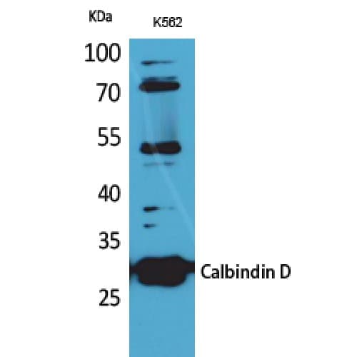 Polyclonal Rabbit anti-Human CALB1 / Calbindin Antibody (181-230 aa, C-terminal, WB)