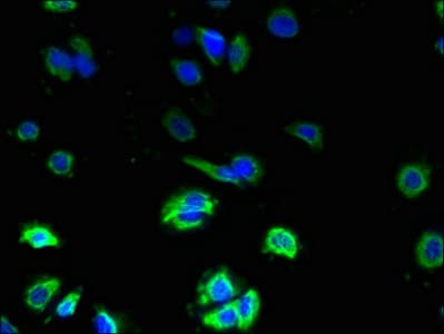 IHC-plus™ Polyclonal Rabbit anti-Human ZDHHC3 Antibody (IHC, WB)