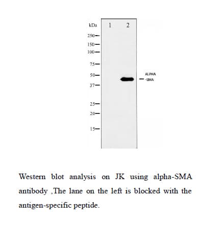 ACTA2 / Smooth Muscle Actin Antibody