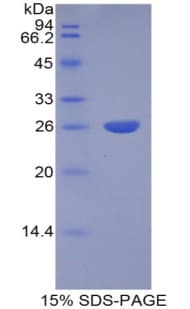 Human CTSS / Cathepsin S Protein (Recombinant His)