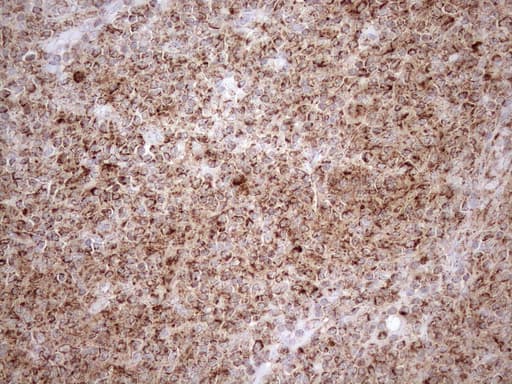 SHMT / SHMT2 Antibody (clone OTI3E9)
