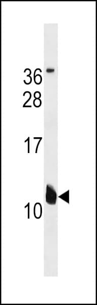 Polyclonal Rabbit anti-Human MIRP1 / KCNE2 Antibody (aa79-107, WB)