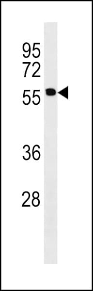 PNPLA2 / ATGL Antibody (aa49-78)