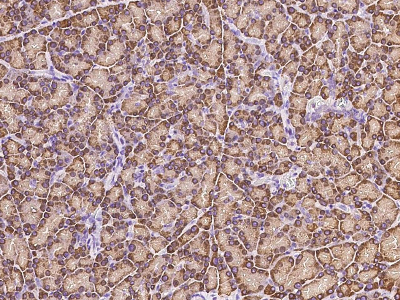 RPS6 / Ribosomal Protein S6 Antibody
