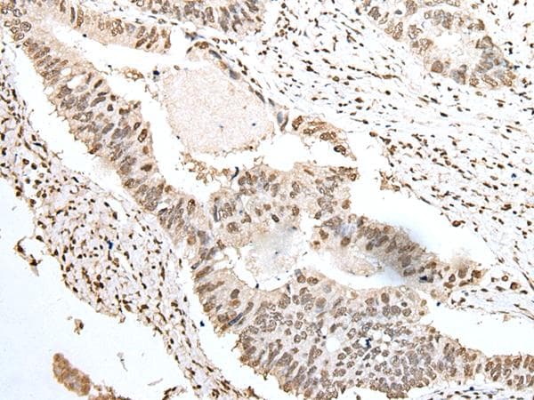 SNRPA / U1A Antibody