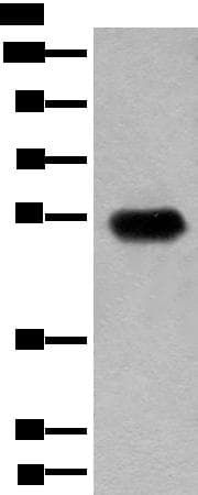 CDT1 Antibody