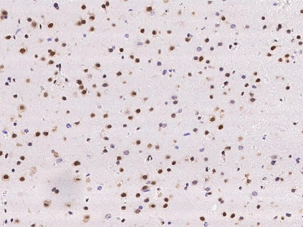 Polyclonal Rabbit anti-Human SCAF8 Antibody (IHC, IF)