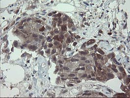 APP / Beta Amyloid Precursor Antibody (clone OTI4C9)