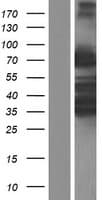 ARHGAP25 Protein (Over-Expression Lysate Myc-DDK (Flag))