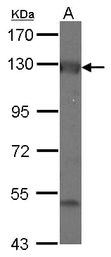 ADCY2 / Adenylate Cyclase 2 Antibody (C-Terminus)
