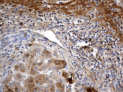 PLG / Plasmin / Plasminogen Antibody (aa301-586, clone OTI4F5)