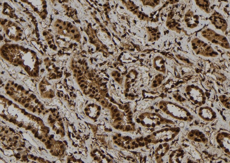 GLI / GLI1 Antibody