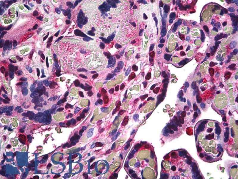 IHC-plus™ RBX1 / ROC1 Antibody (C-Terminus)