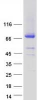 Human ASPIC1 / CRTAC1 Protein (Recombinant Myc-DDK (Flag))