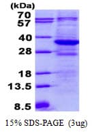 Human TTC33 Protein (Recombinant His)