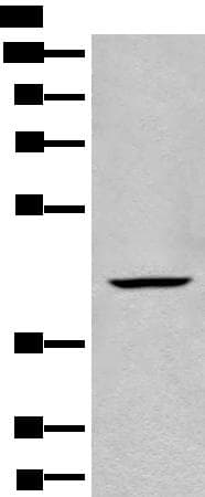 BBOX1 / BBOX Antibody