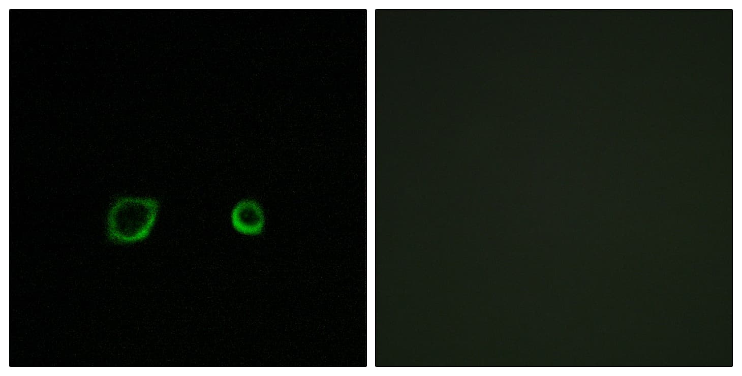 Polyclonal Rabbit anti-Human CNTN4 Antibody (aa661-710, IF)