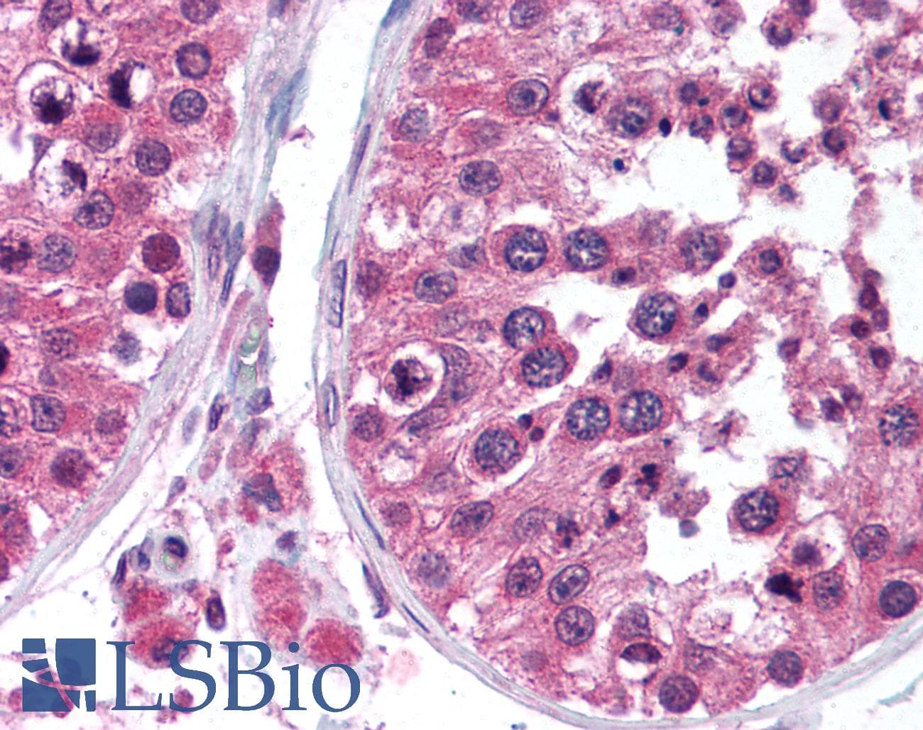 IHC-plus™ Monoclonal Mouse anti-Human TMBIM6 / Bax Inhibitor 1 Antibody (clone 20F430, IHC)