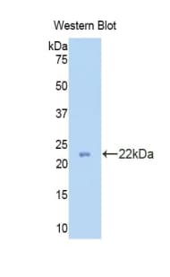PRDX2 / Peroxiredoxin 2 Antibody (aa6-164)