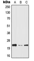 HPGDS Antibody (Internal)