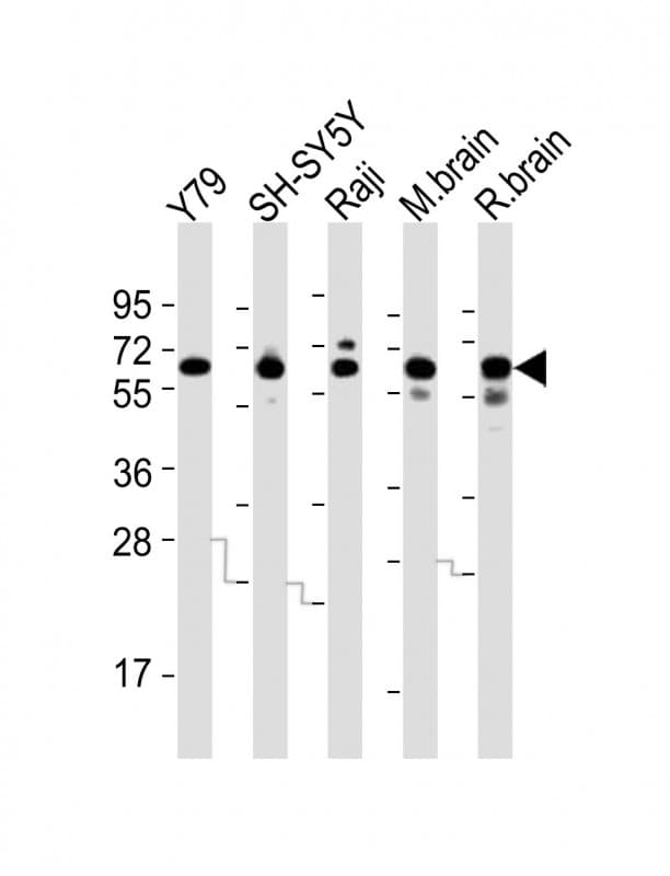 DPYSL5 / CRMP5 Antibody (aa521-554)